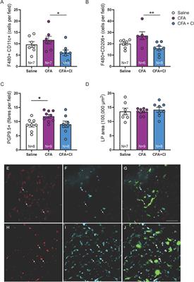 Clodronate Treatment Prevents Vaginal Hypersensitivity in a Mouse Model of Vestibulodynia